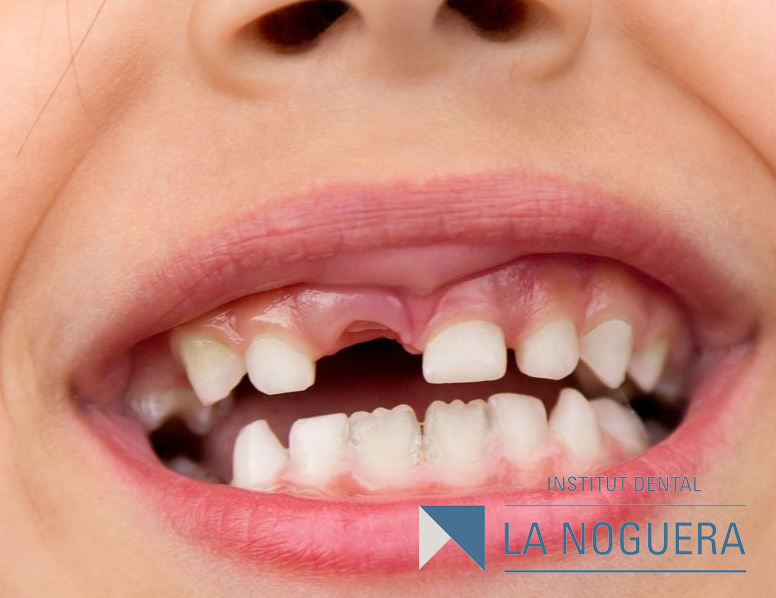 dientes de leche dents de llet. guardar los dientes de leche