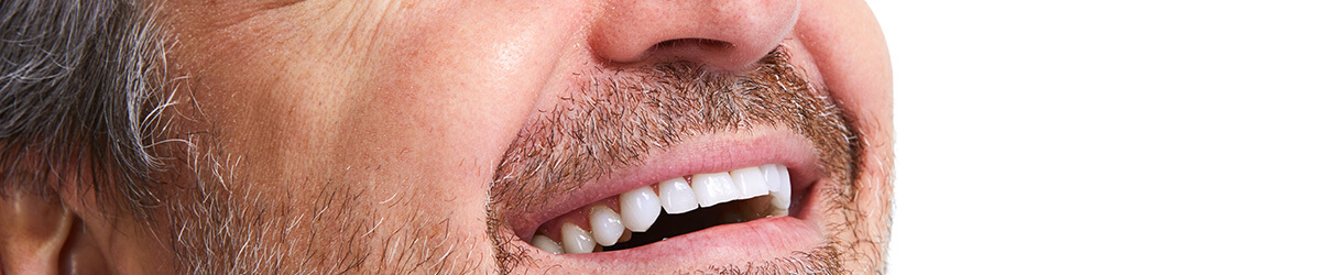 Pròtesi dental - Institut Dental La Noguera