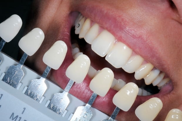 Estètica dental
