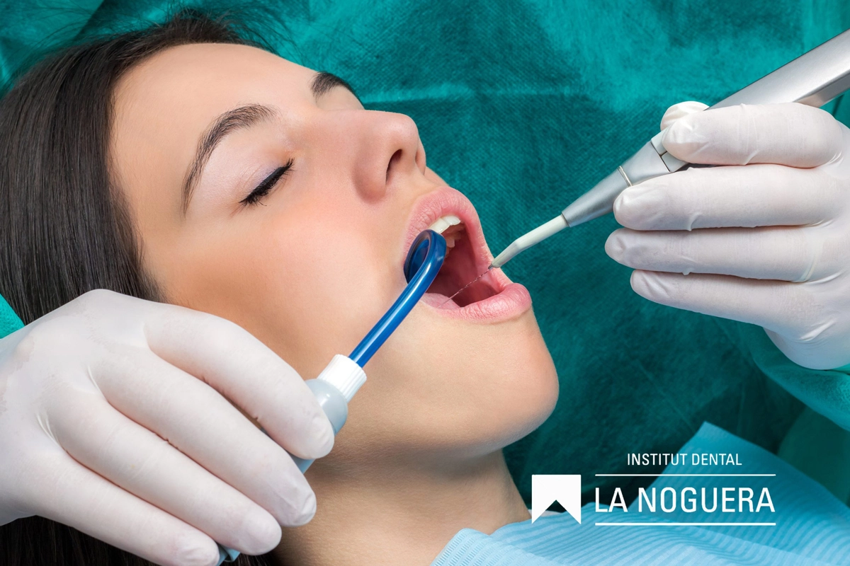 El sarro dental, o càlcul dental, és una acumulació de placa bacteriana que s'endureix a les dents. Prevenir-lo és crucial per mantenir una salut dental òptima i un somriure radiant.